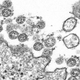 Viral particles of SARS-CoV-2, the virus behind covid-19, seen under a transmission electron microscope in a sample taken from a person.